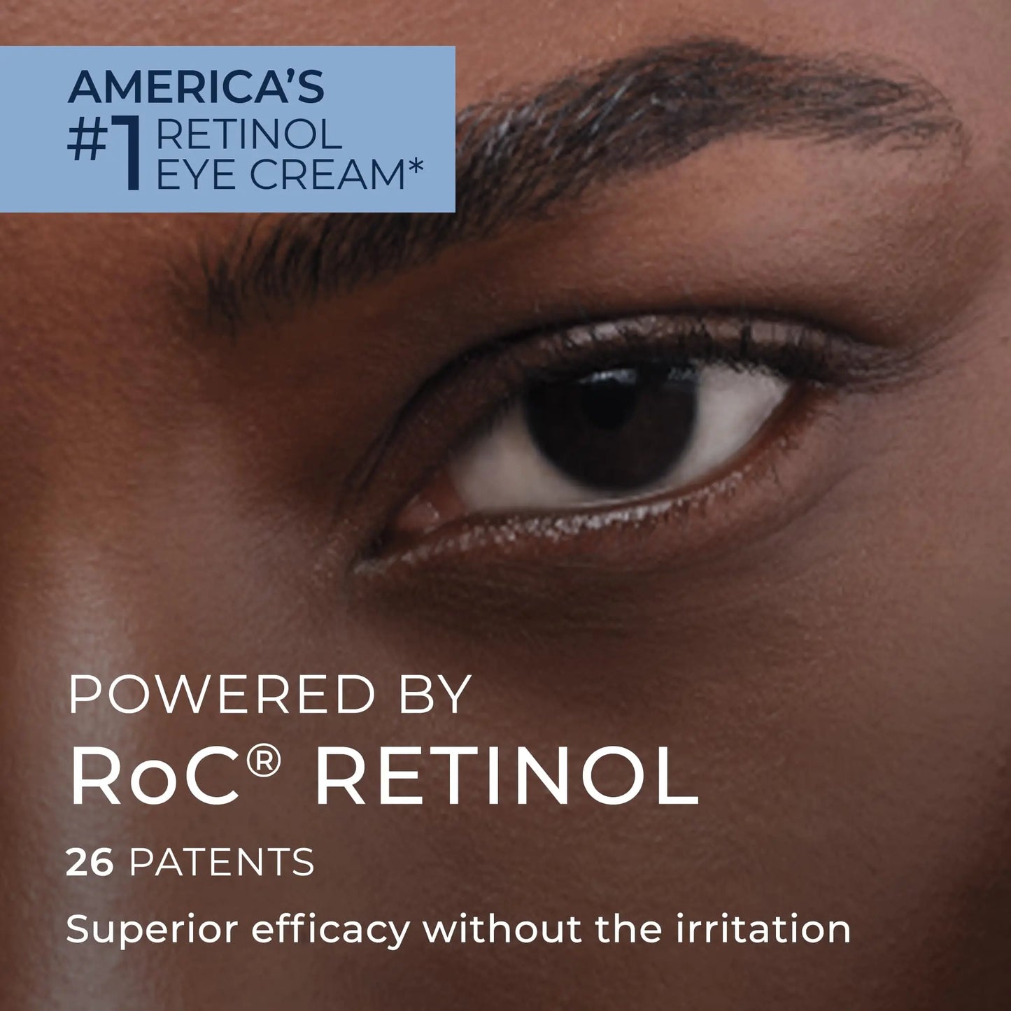 RoC Retinol Correxion Under Eye Cream for Dark Circles & Puffiness, Daily Wrinkle Cream, Anti Aging Line Smoothing Skin Care Treatment for Women and Men, 0.5 oz (Packaging May Vary) 0.5 Fl Oz (Pack of 1)