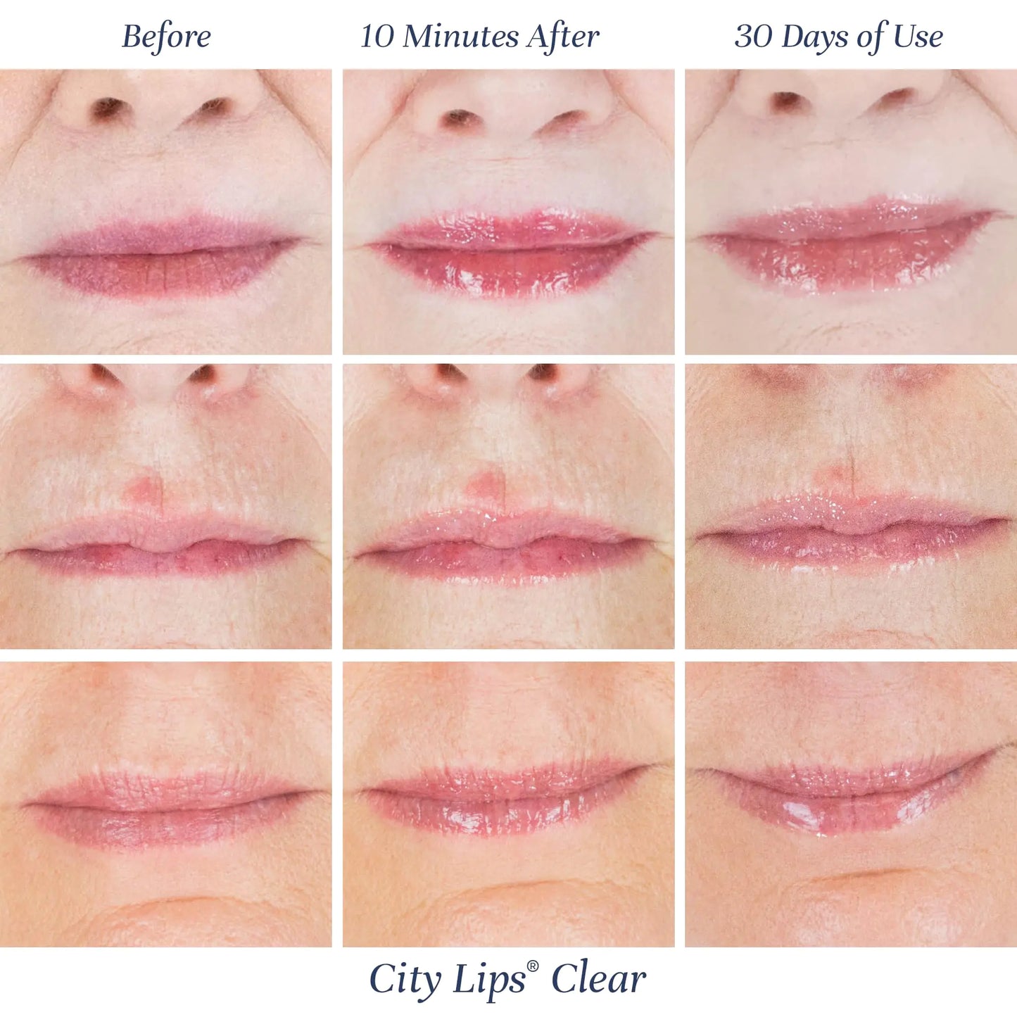 City Beauty City Lips Clear - Plumping Lip Gloss - Hydrate & Volumize - High Shine Lip Plumper - Hyaluronic Acid & Peptides Visibly Smooth Lip Wrinkles - Cruelty-Free